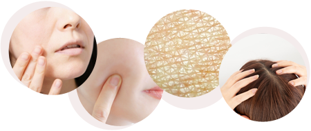 皺・ほうれい線、シミやくすみ、年齢肌やダメージ肌、薄毛や頭皮のダメージが気になる方～イメージ