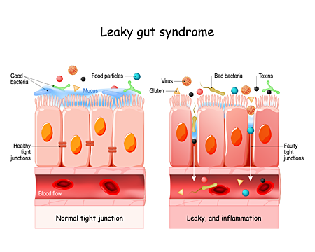 Leaky rut syndrome