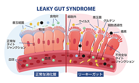 Leaky rut syndrome