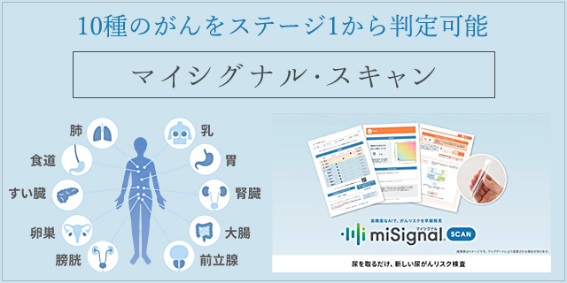 1回の尿検査で10種のがんをステージ1から判定可能　マイシグナルスキャン